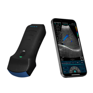 ¡Escríbenos! Ecógrafo Portátil Konted (Modelo inalámbrico de mano).